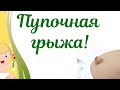 Пупочная грыжа у новорожденного! Что делать???