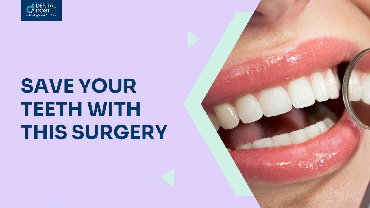 front tooth composite fillings: Do You Really Need It? This Will Help You Decide!