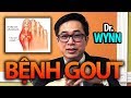 Sức khỏe với Dr. Wynn: Bệnh Gout (Gút)