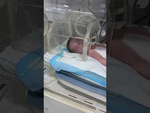 طفل رضيع يتحدى المرض خلونا نوقف معه للنهاية روح العطاء أمجد اكسبلور