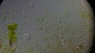Ciliates & Micro-Life Under 100x Oil Immersion Objective | Pond Sample DIC