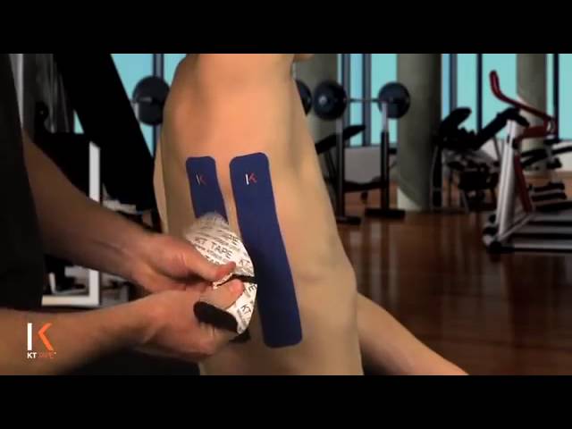 Kinesiotaping for Pregnancy! How KT tape can Help with Rib Pain