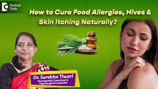 Hives Allergy Treatment At Home | Best Homeopathic Medicines  - Dr. Surekha Tiwari | Doctors' Circle