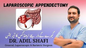 LAPAROSCOPIC APPENDECTOMY. By ( DR. ADIL SHAFI )