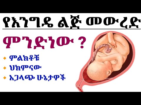 የእንግዴ ልጅ ቀድሞ መምጣት Placenta Previa የሚከሰትበት ምክንያቶች ምልክቶቹ እና ህክምናው