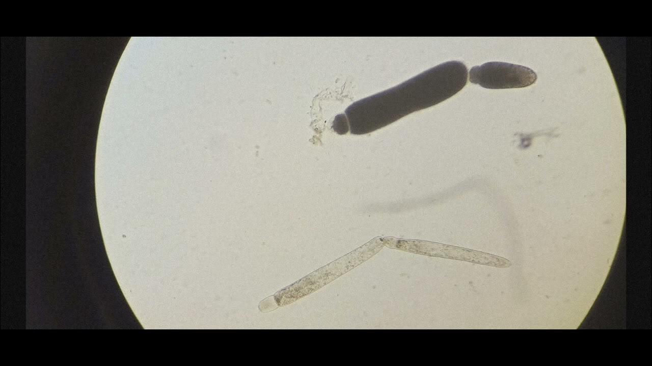 Тип (Переднекомплексные) YouTube