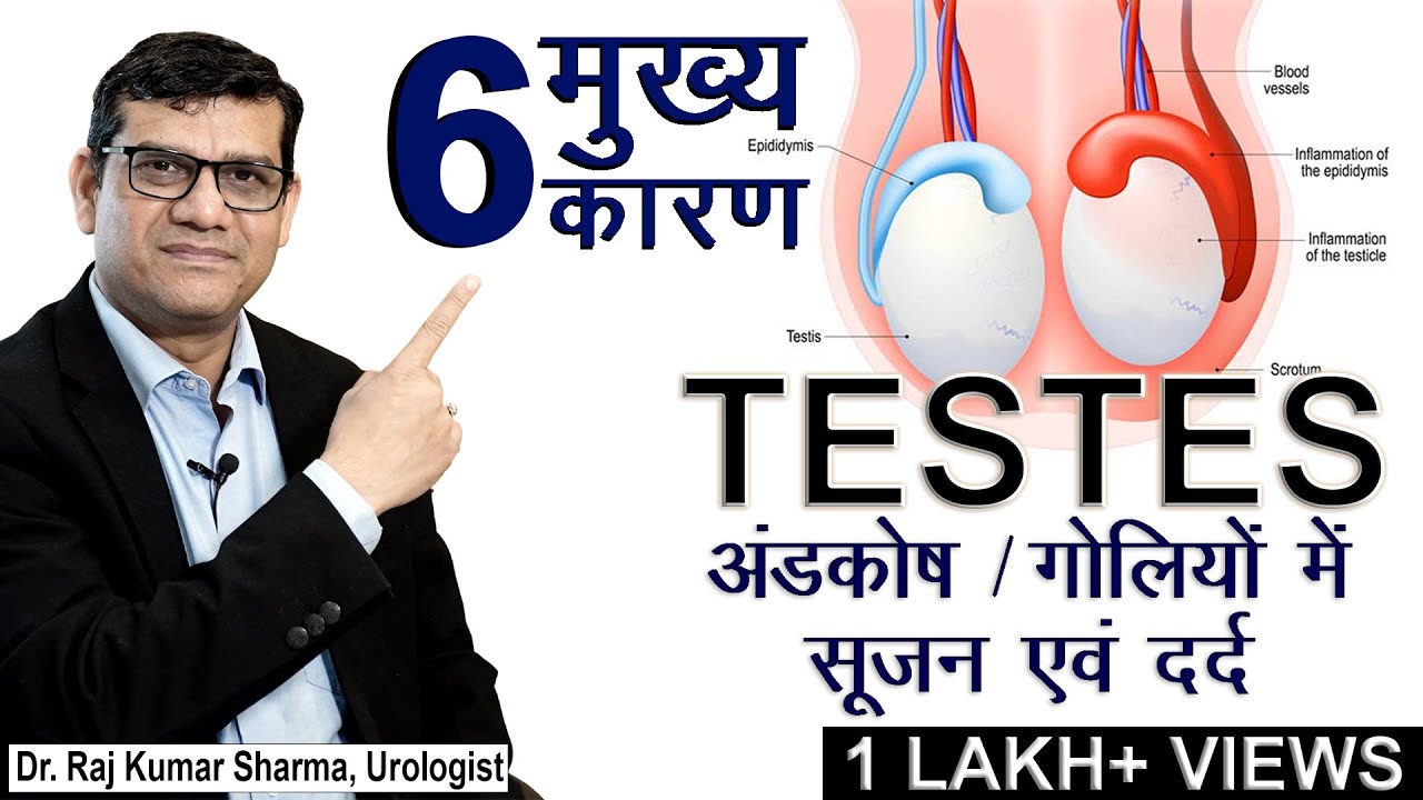 TESTES / अंडकोष / गोलियों  में सूजन एवं दर्द, 6 मुख्य कारण  || Dr. Raj Kumar Sharma - Urologist
