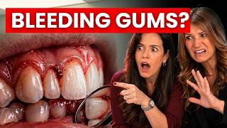 Bleeding Gums? Your Gut Is Screaming At You — Nutritionist Explains