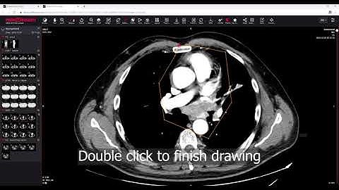 MedDream DICOM Viewer: mark and store the ROI (region of interest)