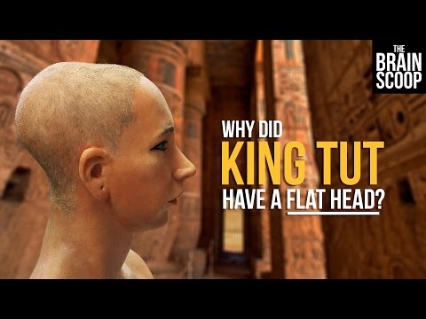 why-did-king-tut-have-a-flat-head?