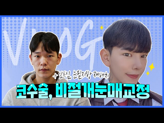 [VLOG] 성형으로 내가 원하던 모습을 얻었다! 👍 #남자성형 #코성형 #비절개눈매교정 #앞트임 #눈밑지방재배치