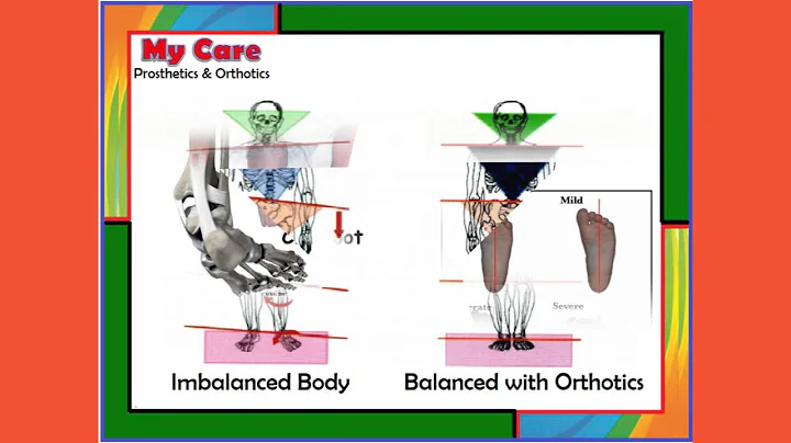 My Care Prosthetics and Orthotics