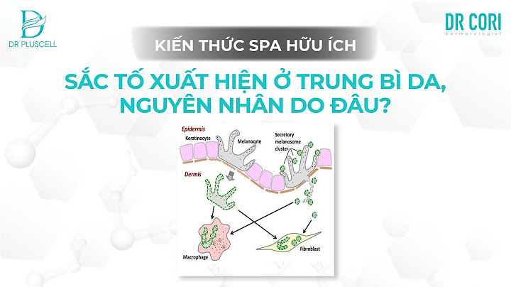 Sắc tố carotenoid có màu nào sau đây