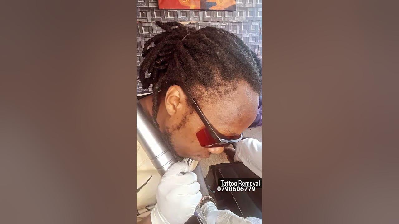 laser-tattoo-removal-0798606779-tattoremoval-tattooremoval-kenya