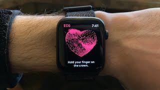 How to Set Up the Electrocardiogram (ECG) Reader on Apple Watch screenshot 5