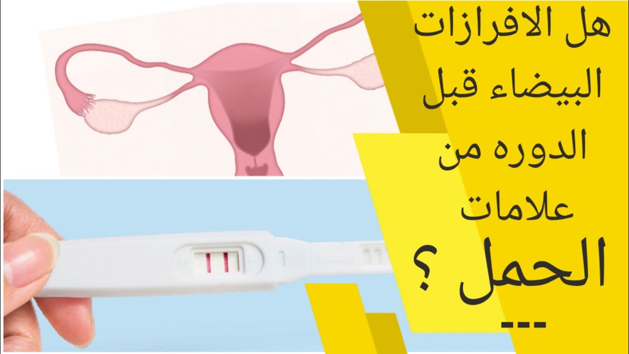هل الإفرازات البيضاء قبل الدورة الشهرية من علامات الحمل؟ إفرازات كريمية أو بيضاء حليبية قبل أسبوع من الدورة الشهرية