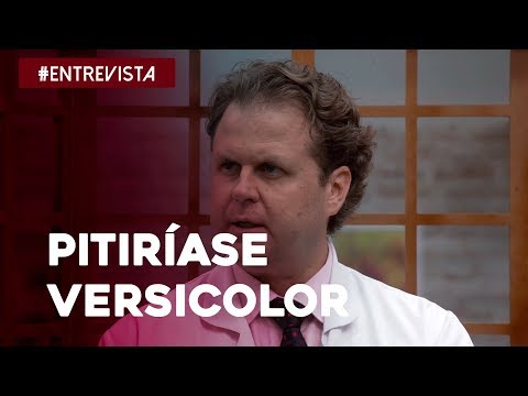 Vídeo: Versicolor Versicolor Em Humanos - Tratamento, Causas De Privação Em Crianças