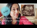 Subchorionic Hematoma - My Story in Hindi | Bleeding Or Spotting During Pregnancy In Hindi | Symptom