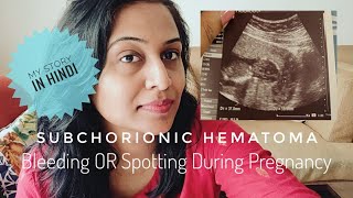Subchorionic Hematoma - My Story in Hindi | Bleeding Or Spotting During Pregnancy In Hindi | Symptom