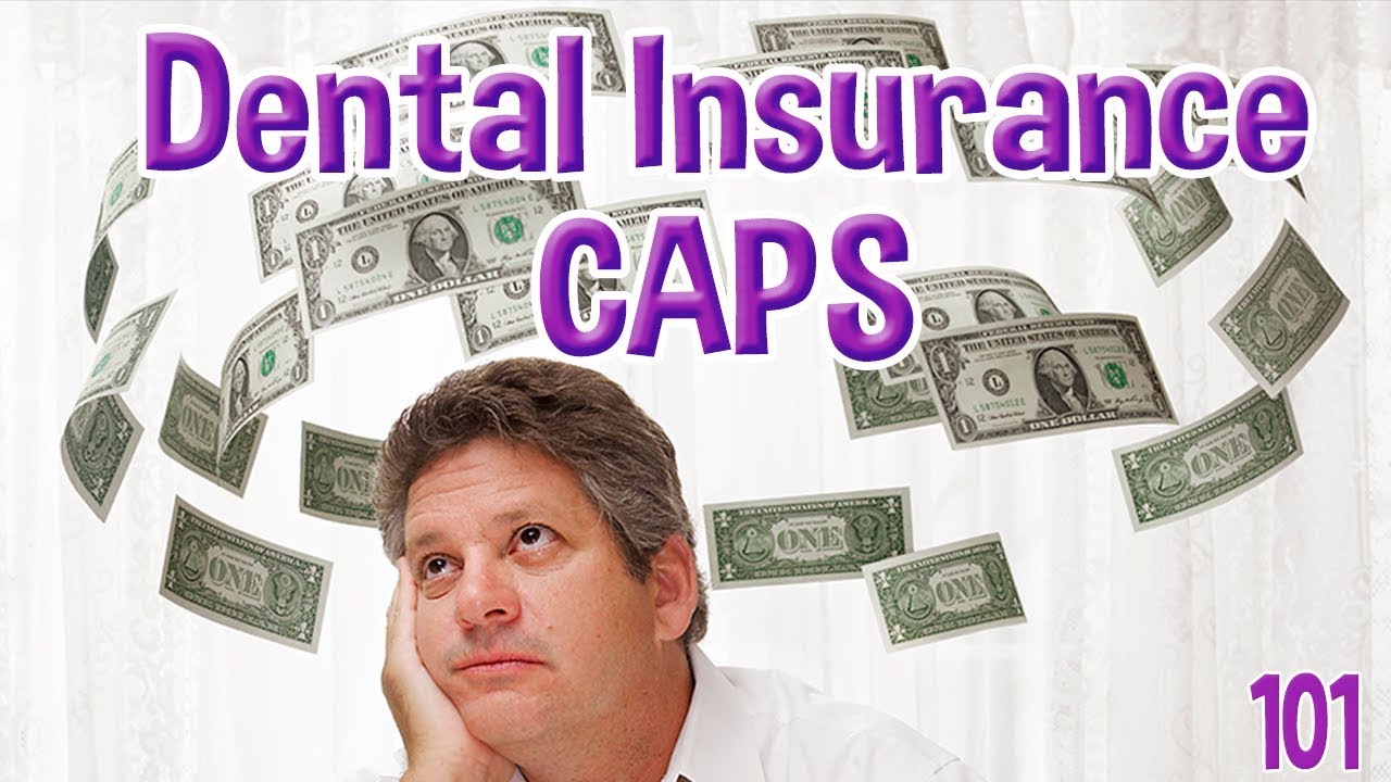 How To Work Around Insurance Limits Viewer Comment Response YouTube