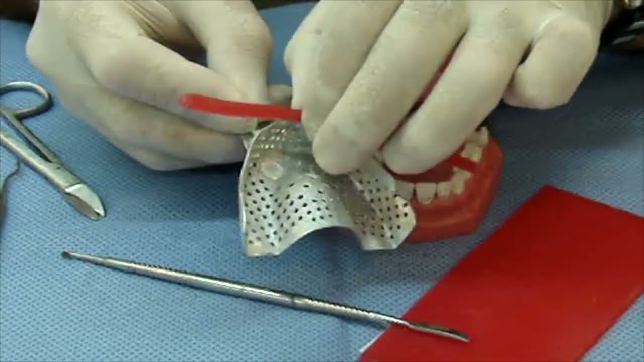 PRÁCTICO - TP #4   CEras