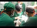 Hospitali Ya Muhimbili Kuanza Kupandikiza Figo Mei 2017 Hospitali Ya Muhimbili Kuanza Kupandikiza Figo Mei 2017