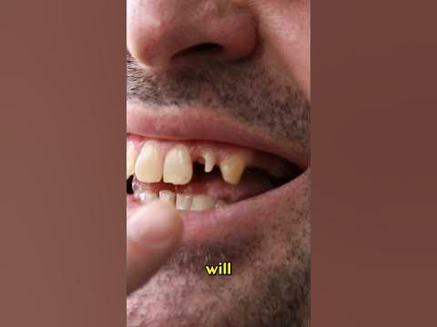 The Romans Gave British People Bad Teeth Part 1 #romanempire - YouTube