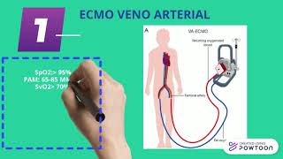 ECMO MONITOREO