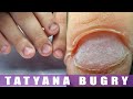 Nail Bitter Transformation! | Transforming Bitten Nails Using Polygel & Nail Forms