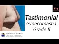 Gynecomastia grade  ii  shobhit aesthetics  chest liposuction  gland excision