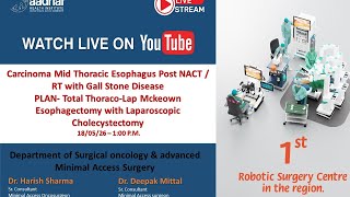 Carcinoma Mid Thoracic Esophagus Post NACT / RT with Gall Stone Disease   PLAN- Total Thoraco-Lap Mc