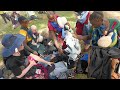 ALBINISM COMMUNITY TACKLES STIGMA AND VIOLENCE THROUGH EDUCATION