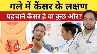 गले में कैंसर होने के लक्षण | Throat Cancer symptoms | गले के कैंसर की पहचान कैसे करें