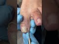 Satisfying Toenail Grooming | Gentle Foot Care Routine #fypシ #cleannails #RelaxingCare #fypシ