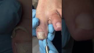 Satisfying Toenail Grooming | Gentle Foot Care Routine  #fypシ #cleannails #RelaxingCare #fypシ