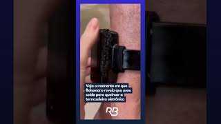 Full Bolsonaro revela que usou solda para queimar a tornozeleira eletrônica News