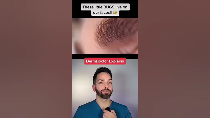 Bugs on the Skin?! 🐛 #shorts