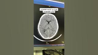 الفرق بين الأشعه المقطعية و الرنين المغناطيسي