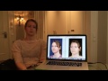 Facial Feminization Surgery Review - Alexandra, Dr Bart van de Ven reviews