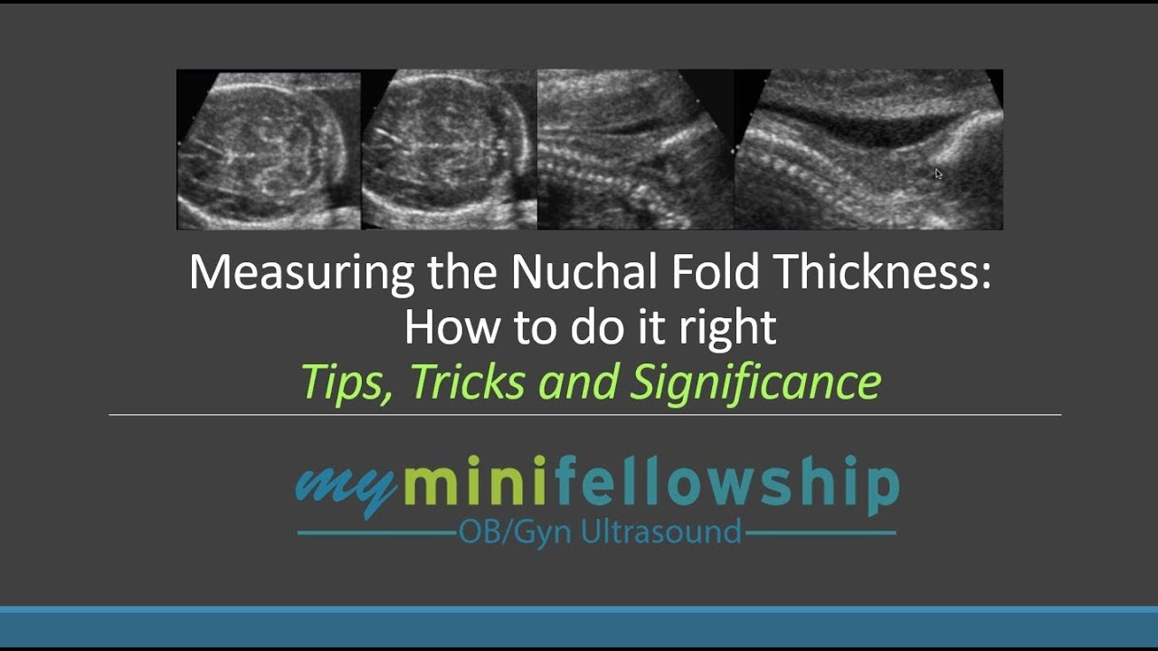 What is a nuchal fold