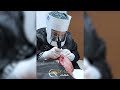 Hair Transplant Operation Process