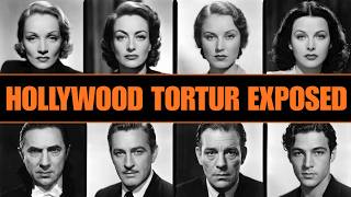 The Tragic Golden Age Stars Who Secretly Wore Painful Prosthetics