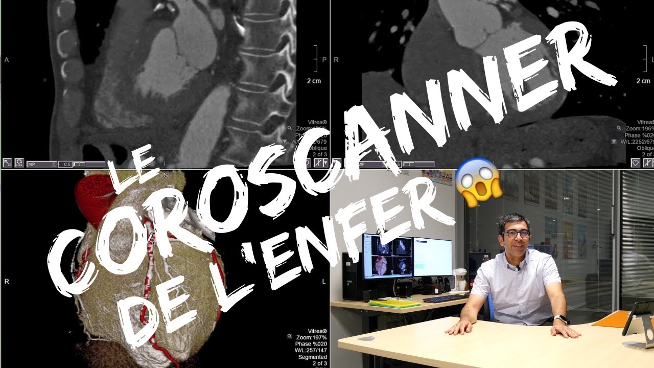 Un coroscanner TRES difficile cas clinique didactique YouTube Un coroscanner TRES difficile cas clinique didactique YouTube
