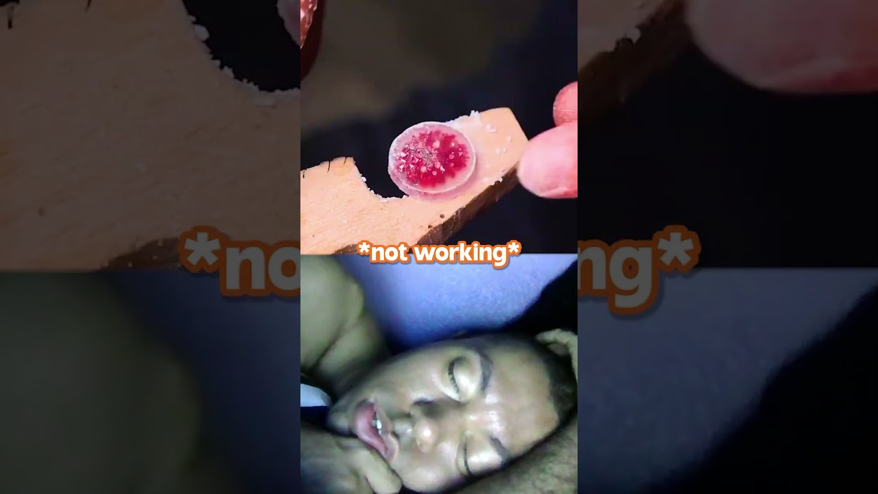 "Survival Instincts Of A Walnut" 😭💀