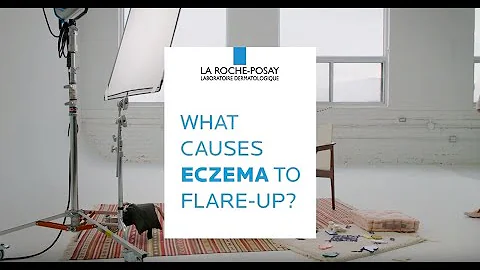 What Causes Eczema to Flare Up - DERMCLASS
