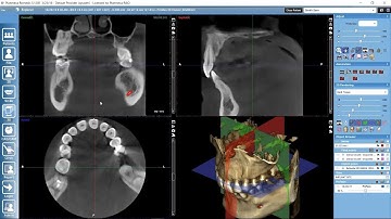 Examining 3D images in Planmeca Romexis