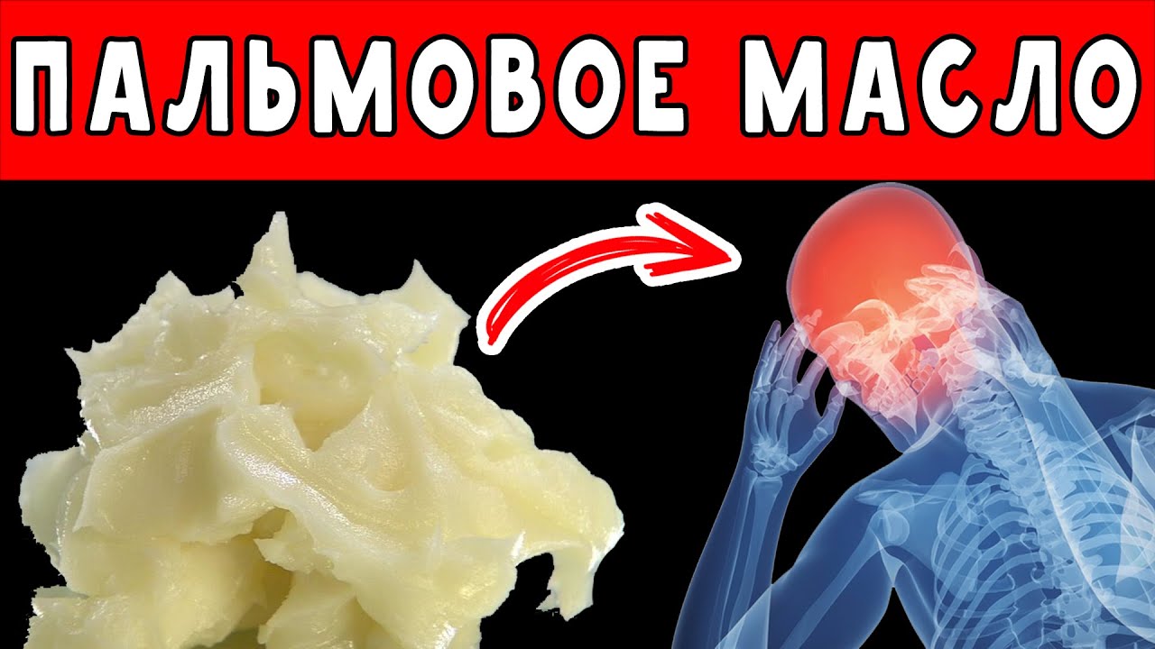 ПАЛЬМОВОЕ МАСЛО - ПОЛЕЗНО или ВРЕДНО 👍 Вся ПРАВДА о ПАЛЬМОВОМ МАСЛЕ