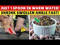 Ankle Swelling: 1 Daily Habit That Drains Water Retention Overnight | Senior Health Tips