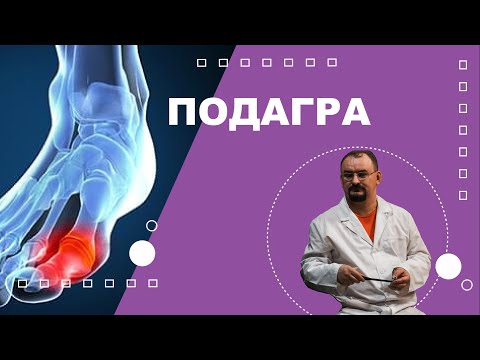 Подагра. Лечение подагры.