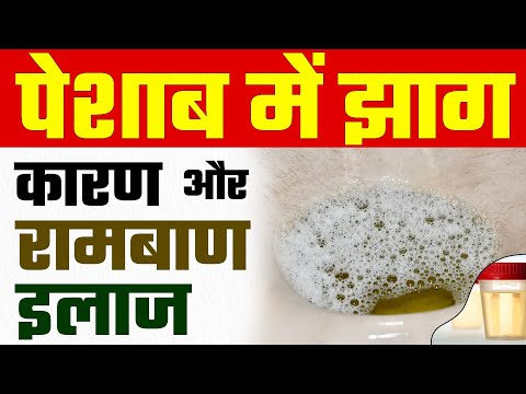 पेशाब में झाग आने का कारण और रामबाण इलाज | Signs of Foamy Urine | Proteinuria Treatment